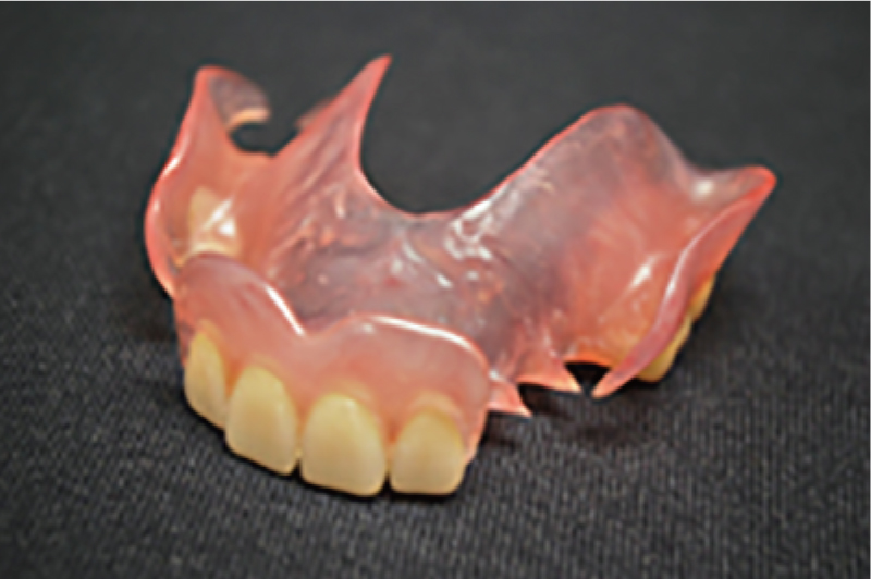 バルプラスト義歯（ノンクラスプ義歯）